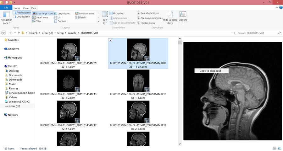 MicroDicom Shell Extension