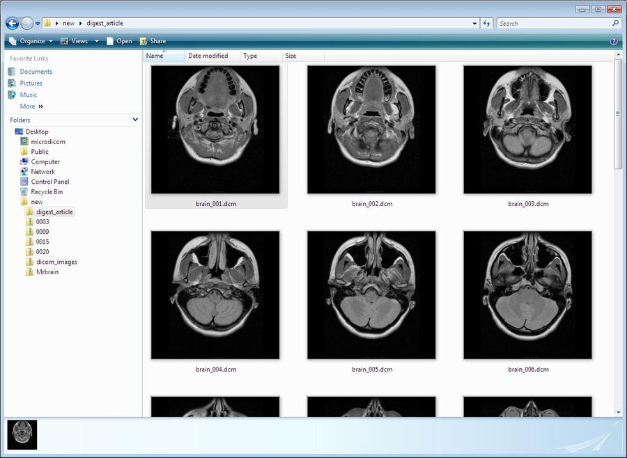 бесплатно MicroDicom Shell Extension