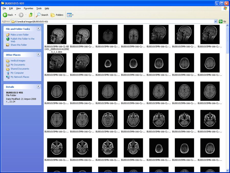 скачать MicroDicom Shell Extension